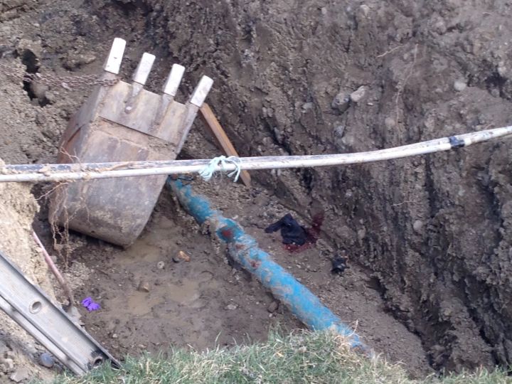 Trench injury Calgary