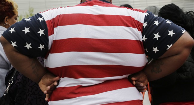 In this May 8, 2014 file photo, an overweight is seen in New York. International diabetes organizations are calling for weight-loss surgery to become a more routine treatment option for diabetes, even for some patients who are only mildly obese. Obesity and Type 2 diabetes are a deadly pair, and numerous studies show stomach-shrinking operations can dramatically improve diabetes. 