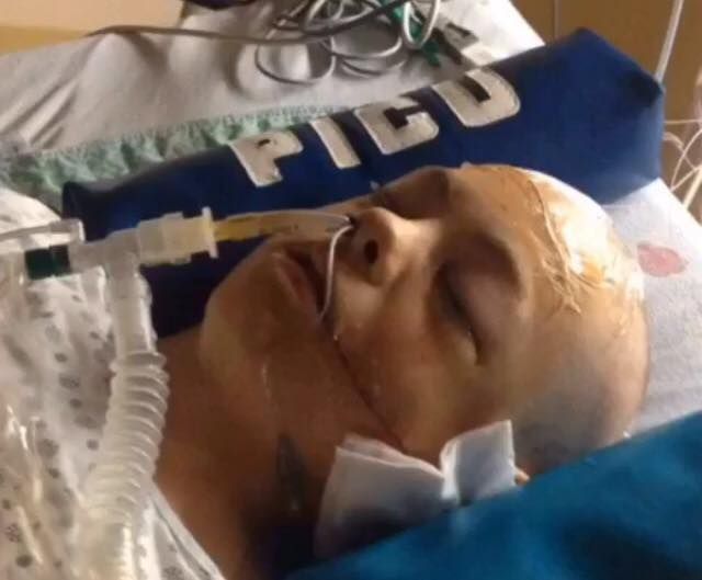 Braydon Heather, 14, is in the hospital after being found with serious head injuries from an assault June 21, 2016.