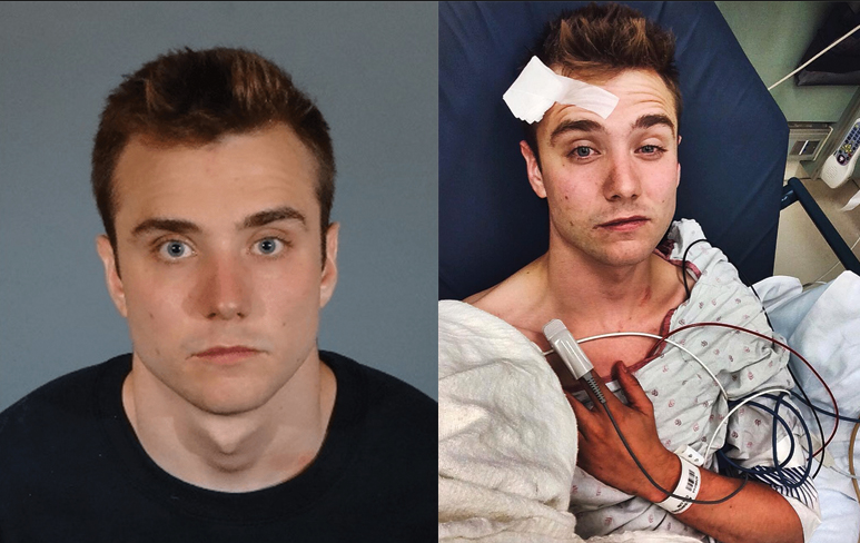 YouTube personality Calum McSwiggan has been charged with filing a false police report and faking his injuries.
