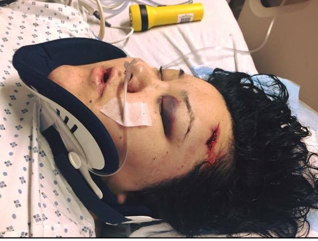 Jackie Healey recovers in hospital after a vicious beating at the Behavioral Health Foundation. A third suspect has been arrested for his role in the attack.