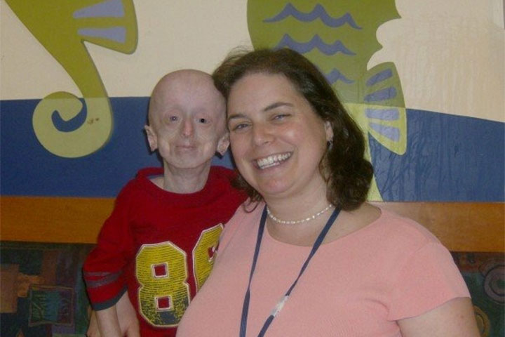‘Forever in my heart’: Ontario man with rare aging disorder dies at 20 - image