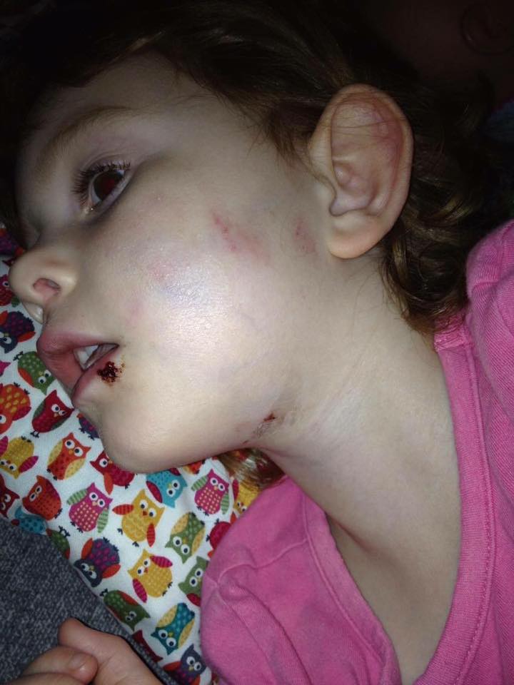 Dog given back to Edmonton owner after biting twin girls - image