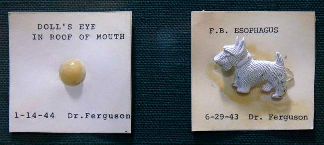 Yuck! The weird things kids swallow go on display - image