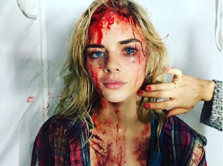 Bloody girl trump 2025 hoax