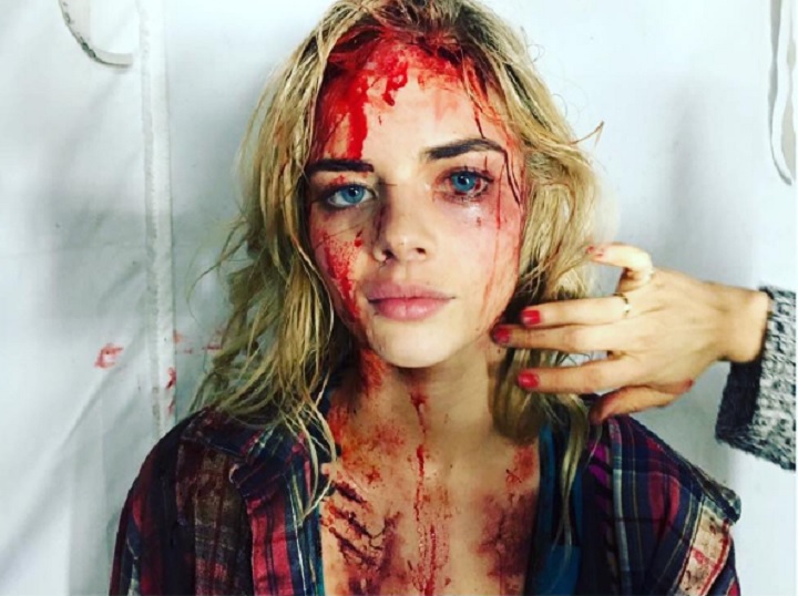 This is not a Donald Trump supporter who was beaten up at a rally; it's Australian actress Samara Weaving covered in fake blood on the set of the Starz series 'Ash vs. Evil Dead.