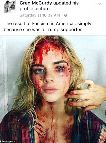 Bloodied ‘Trump supporter’ in hoax photo is ‘Ash vs Evil Dead’ actress Samara Weaving - image