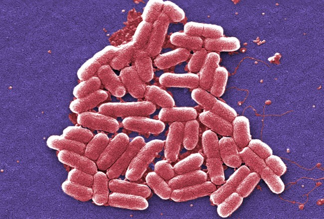 Q&A: Superbug precursor found in US again - image