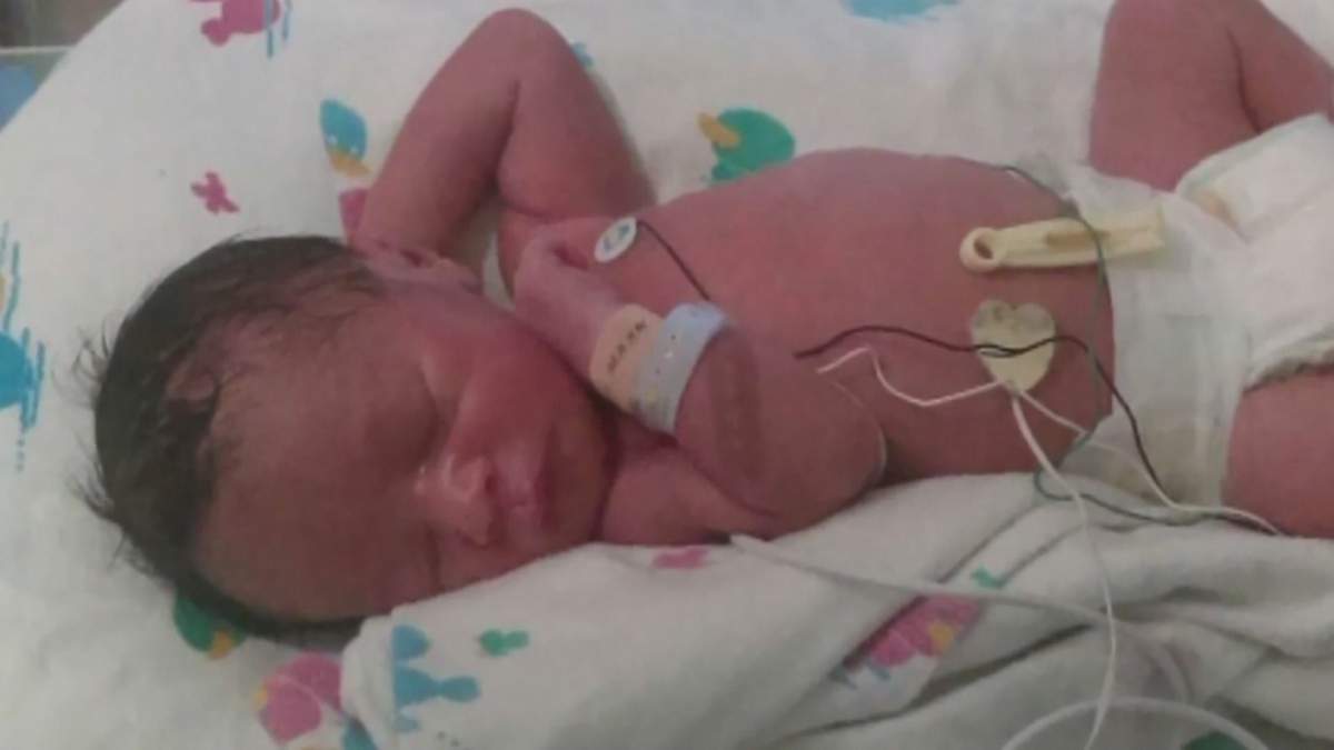 Pregnant ‘Pokemon Go’ player hit by car, given emergency C-section to save baby - image