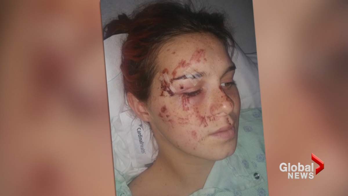 Pregnant ‘Pokemon Go’ player hit by car, given emergency C-section to save baby - image