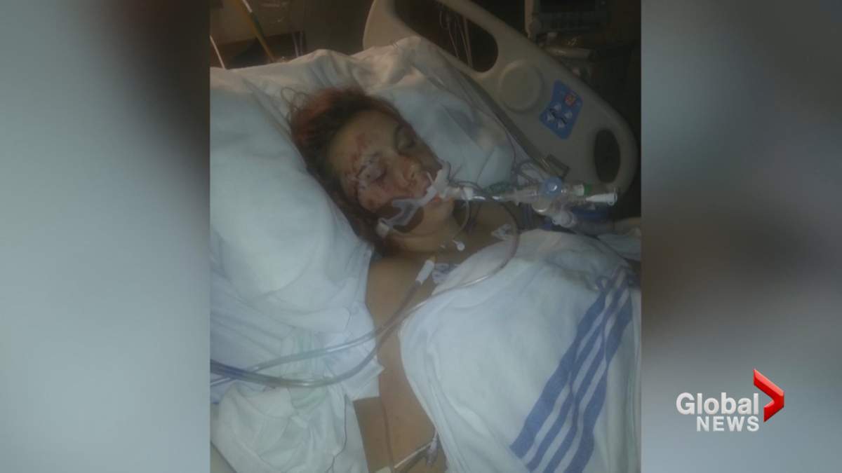 Pregnant ‘Pokemon Go’ player hit by car, given emergency C-section to save baby - image