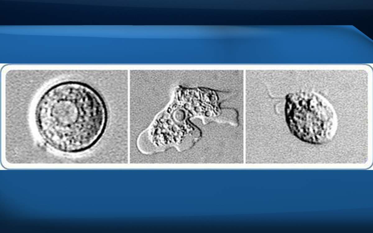 This combo of images provided by the Center for Disease Control shows the Naegleria fowleri amoeba in the cyst stage, left, trophozoite stage, center and the flagellated stage, right.