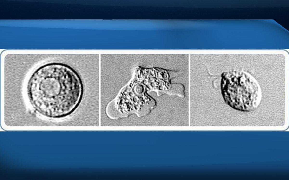 This combo of images provided by the Center for Disease Control shows the Naegleria fowleri amoeba in the cyst stage, left, trophozoite stage, center and the flagellated stage, right.