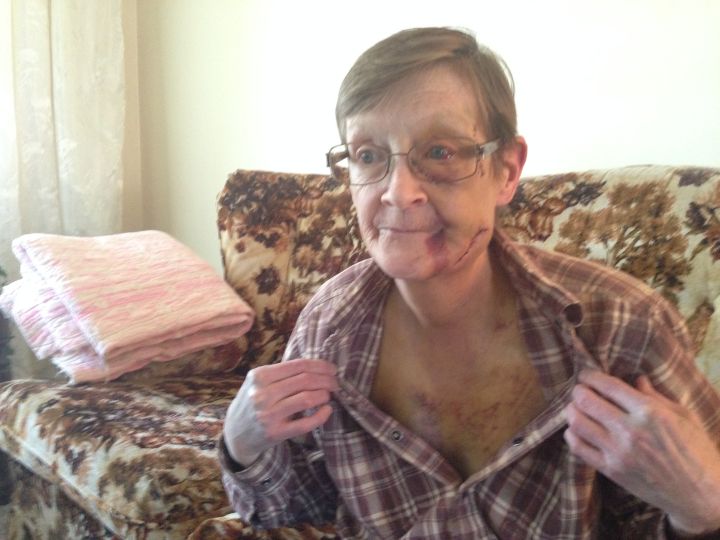 Calgary couple attacked