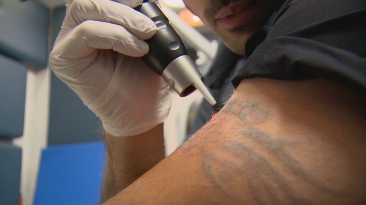 Canadian veteran-turned-businessman operates mobile tattoo removal service  