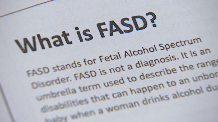 FASD is a neurodevelopmental disorder resulting from the consumption of alcohol during pregnancy and leads to permanent  "behavioural and intellectual problems".