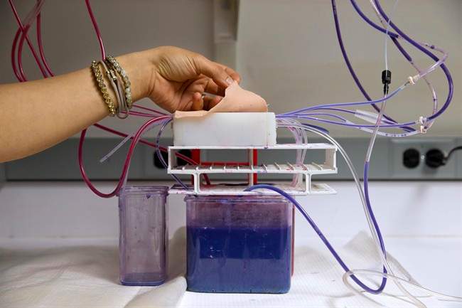 Studies shine light on mysterious placenta, how it goes awry - image