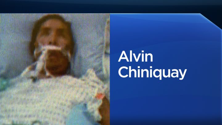 Alvin Chiniquay has been identified as the victim in a Sept. 9, 2016 beating in the Calgary Remand Centre.