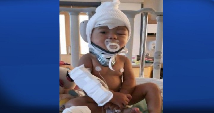 Toddler who fell out of window recovering, family upset at online ...
