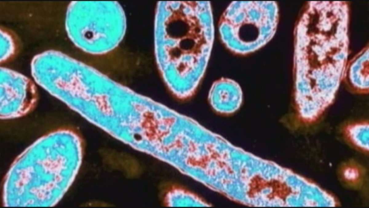 Legionella bacteria discovered at Winnipeg’s Victoria Hospital, experts say not to worry - image