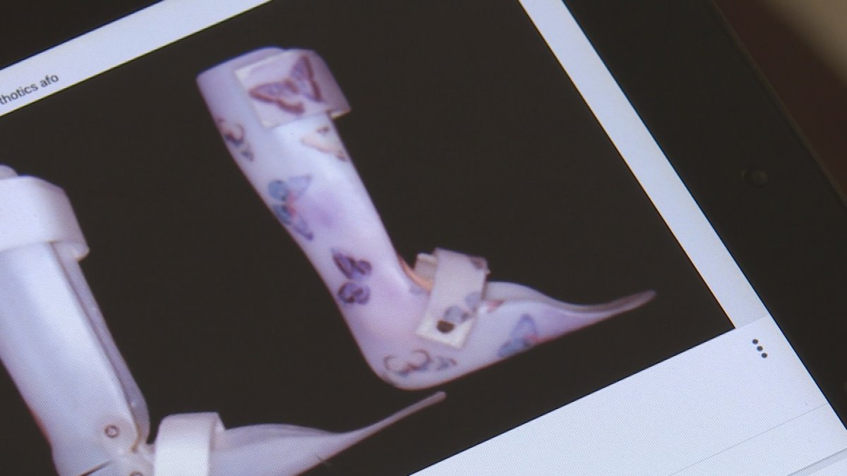 Specialized orthotics stolen from Kelowna girl Globalnews.ca