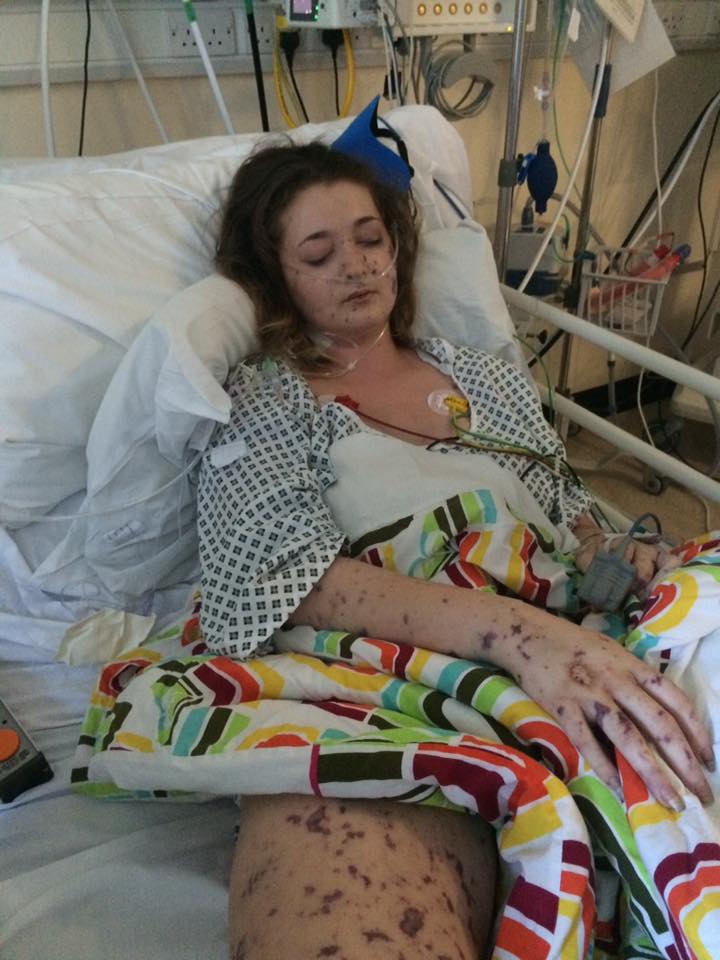 Photos from Charlene Colechin's Facebook page document her battle with bacterial meningitis. 