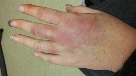 Kimberly's hand after exiting the maze Saturday night. 