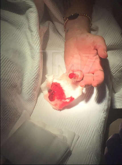 Lindsay Lohan almost ‘loses a finger’ in boating accident - image