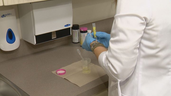 University of Saskatchewan officials say their world record attempt is an effort to raise awareness about the importance of testing and treating STIs.