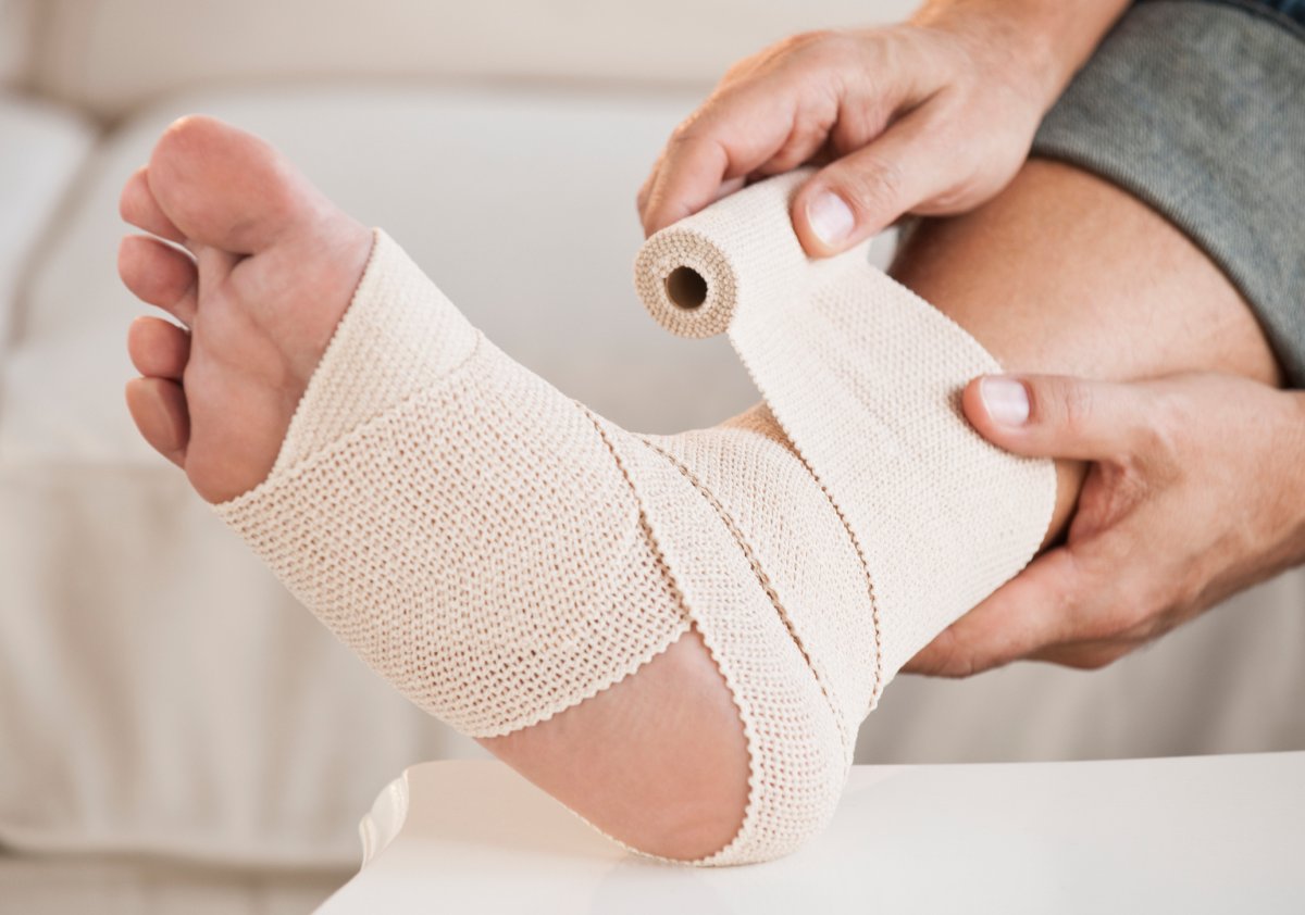 More than 40 per cent of people fil to recover from a sprain ankle because of persistent pain, recurrent injury and instability, researchers say.