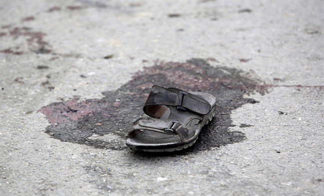 A victim's sandal is pictured near the Shiite Baqir-ul Ulom mosque after a suicide attack, in Kabul, Afghanistan, Monday, Nov. 21, 2016. An Afghan official says that dozens of civilians have been killed after a suicide bomber attacked a Shiite mosque in the capital. (AP Photos/Massoud Hossaini).