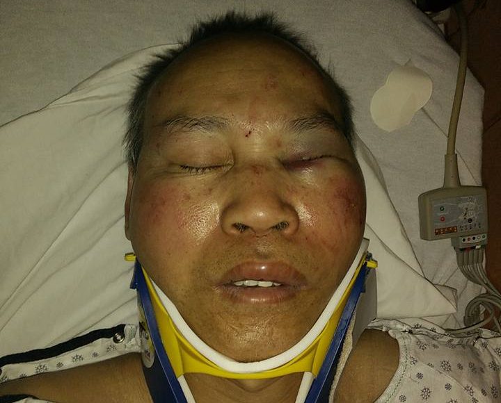 Narith Taing was brutally beaten Monday, December 19, 2016.