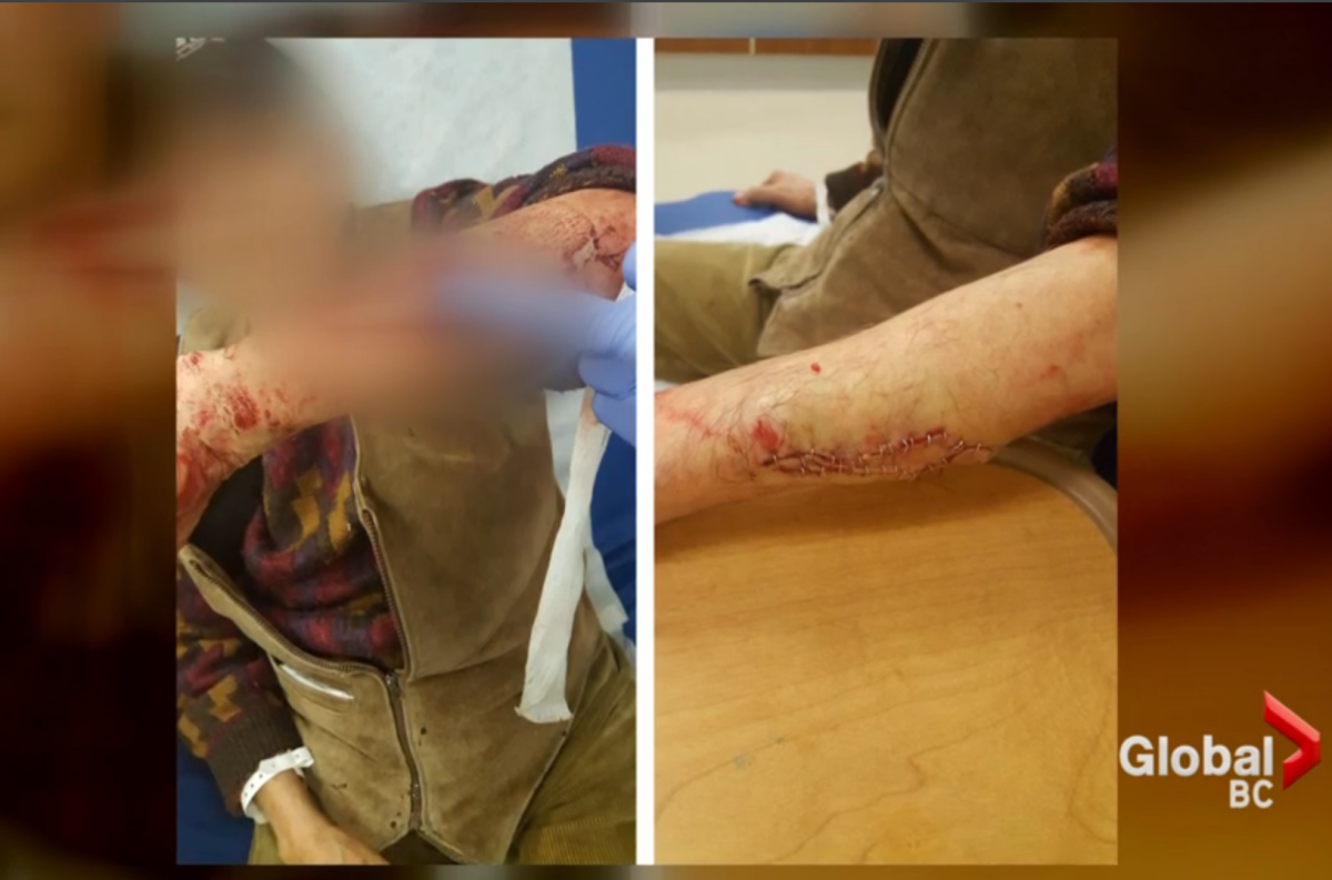 Two dogs to be put down after attacking 75-year-old Surrey man - image