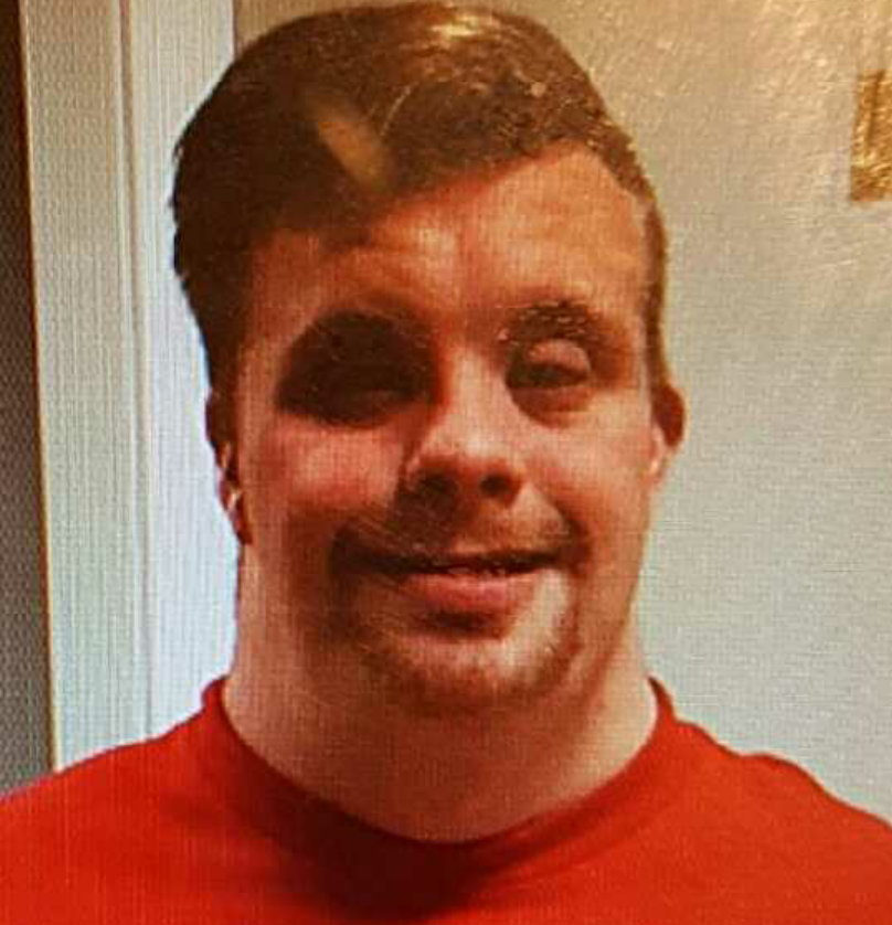 Vancouver police search for missing man with Down syndrome - image