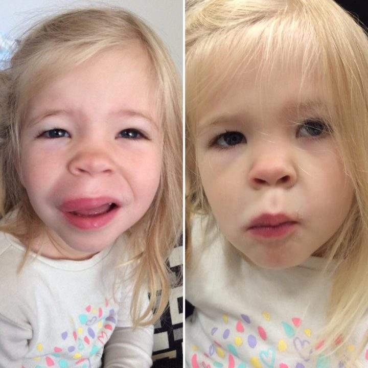 Families with severe food allergies not happy with McDonald’s recent decision - image