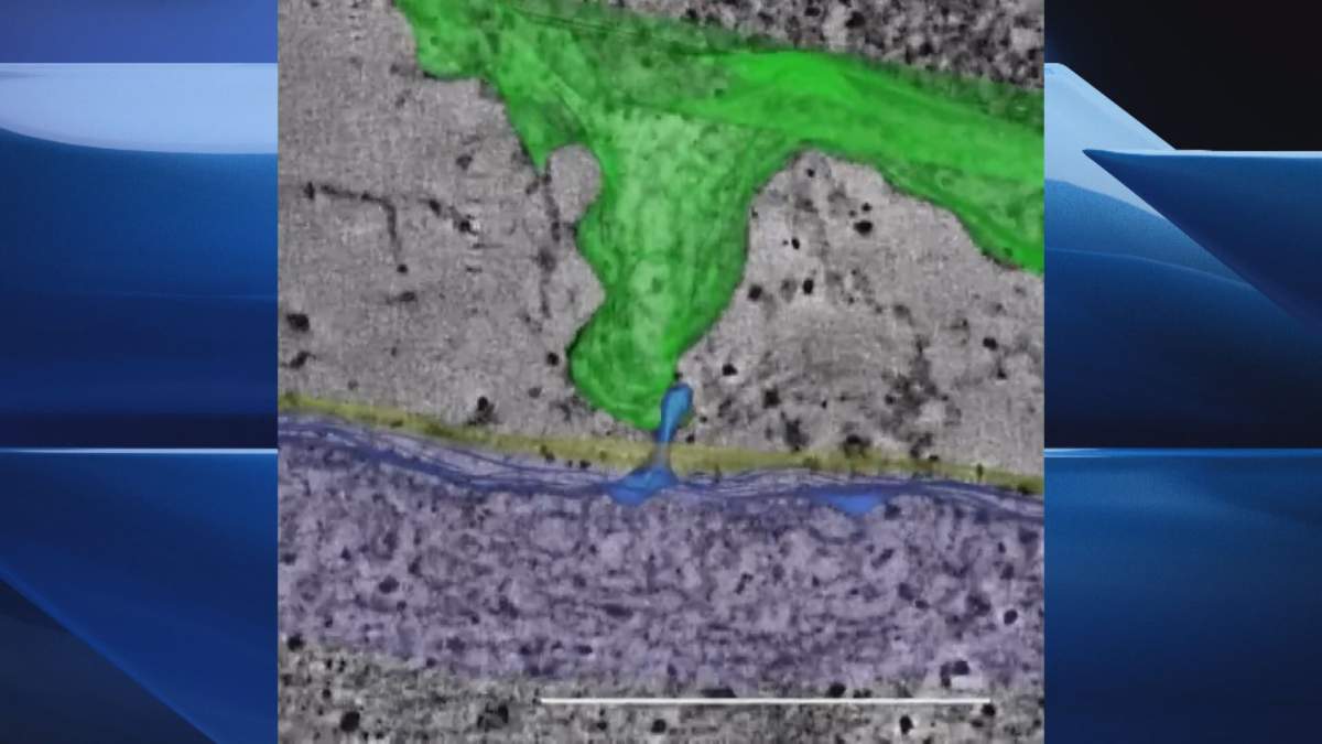 Part of the scar tissue (green) connects with the healthy tissue (blue) in a mouse's heart.