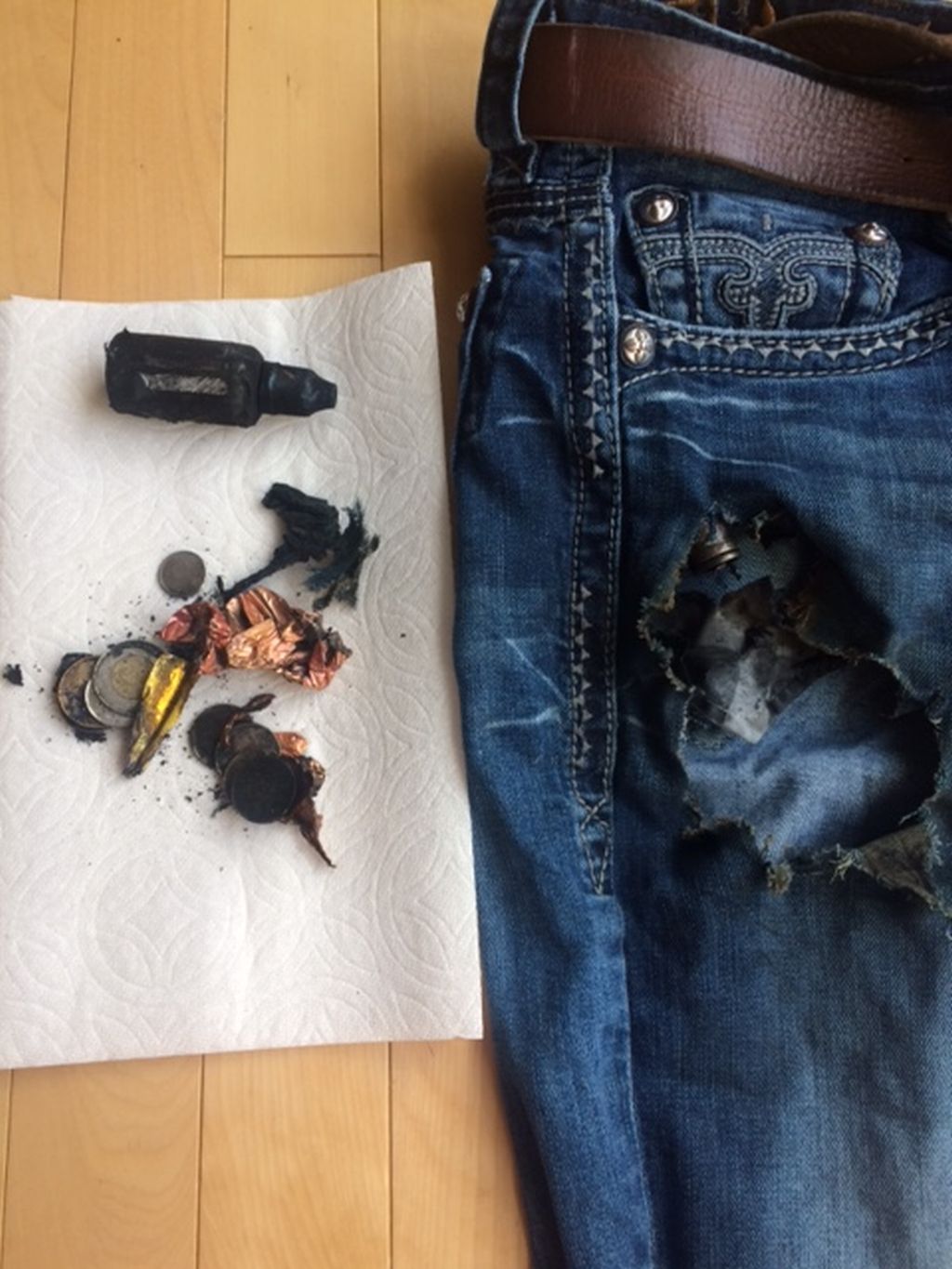 Calgary man suffers 3rd degree burns after e-cigarette battery explodes in pocket - image