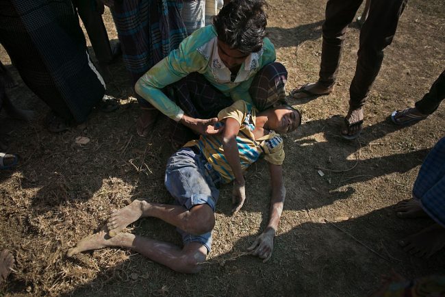 A Rohingya boy lies injured on the ground after he fell from a high hill as he was building his house in the Balu Kali refugee camp on January 17, 2017 in Cox's Bazar, Bangladesh. 