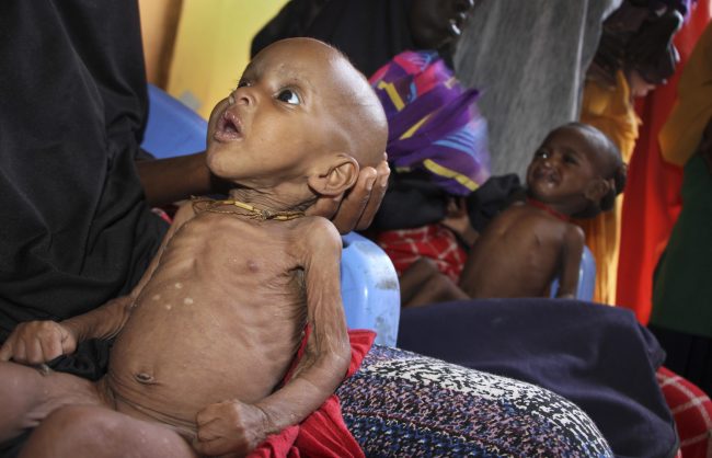 Malnourished babies are held by their mothers at a feeding center in Mogadishu, Somalia, Feb. 25, 2017.
