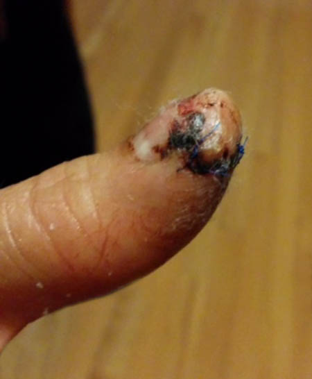 Violence against nurses on the rise in British Columbia - image