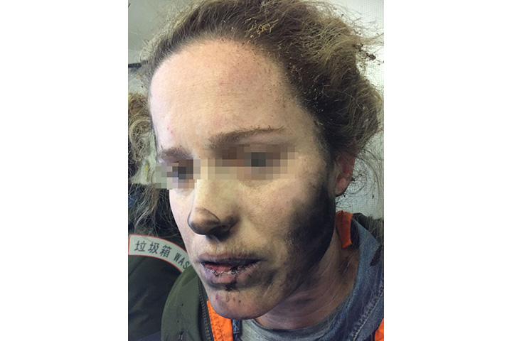 Sleeping passenger suffers burns after her headphones exploded on Australia-bound flight - image