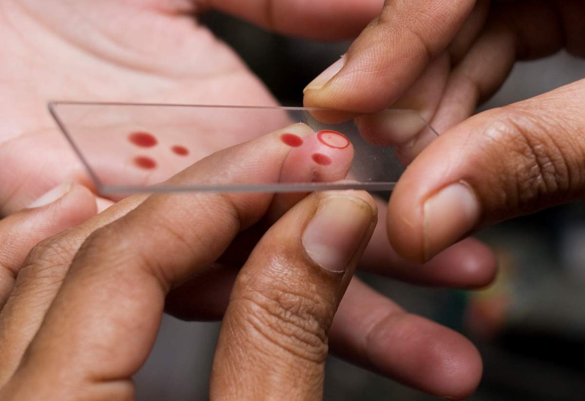 Scientists out of the University of California in San Diego say they’ve developed a new blood test that could pave the way to diagnosing cancer early on without having to do invasive surgeries like biopsies.