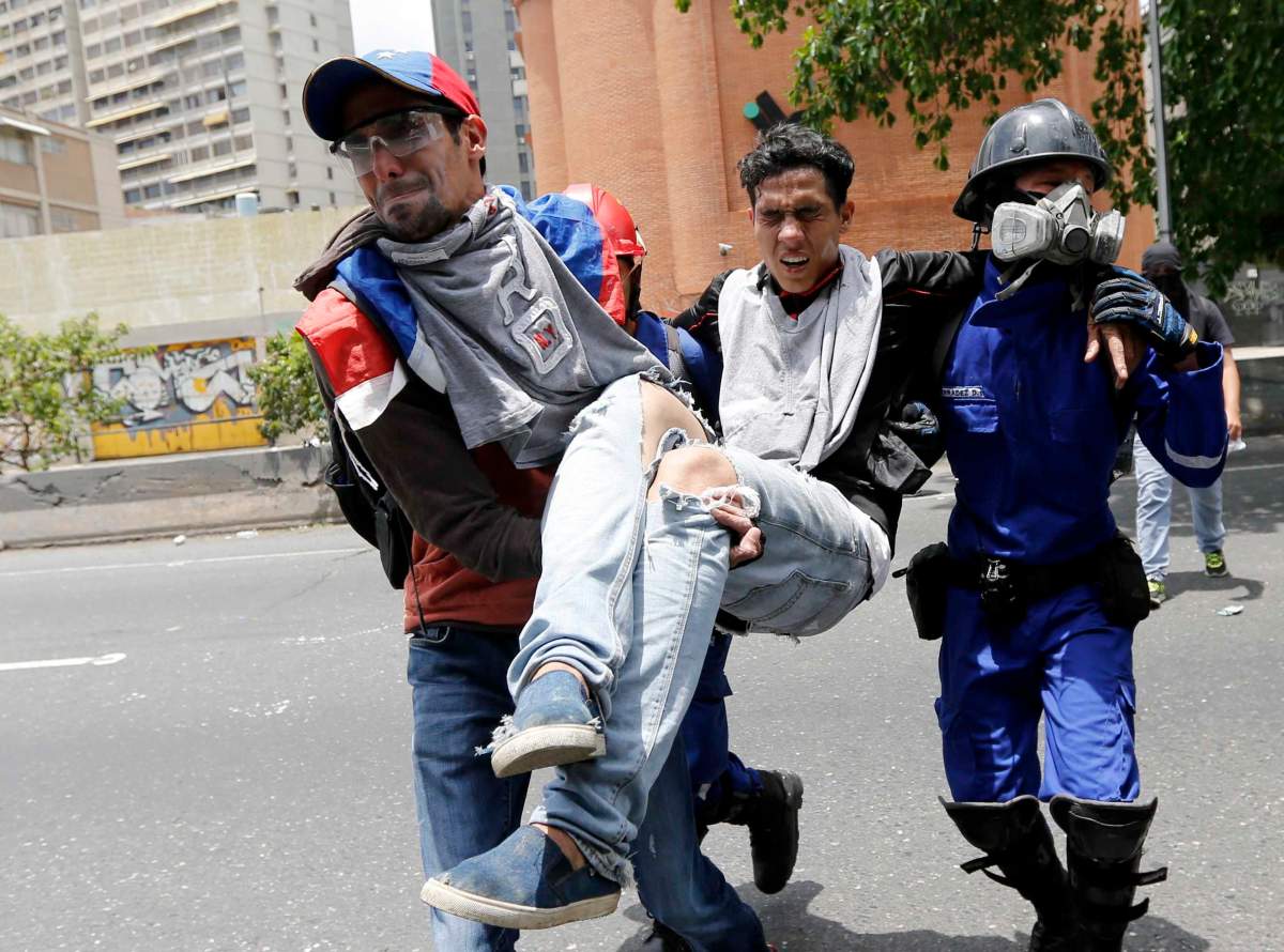 A protester is carried after being injured in clashes with security forces during anti-government protests in Caracas, Venezuela, Wednesday, April 19, 2017. Tens of thousands of opponents of President Nicolas Maduro flooded the streets of Caracas in what’s been dubbed the “mother of all marches” against the embattled president. (AP Photo/Ariana Cubillos)