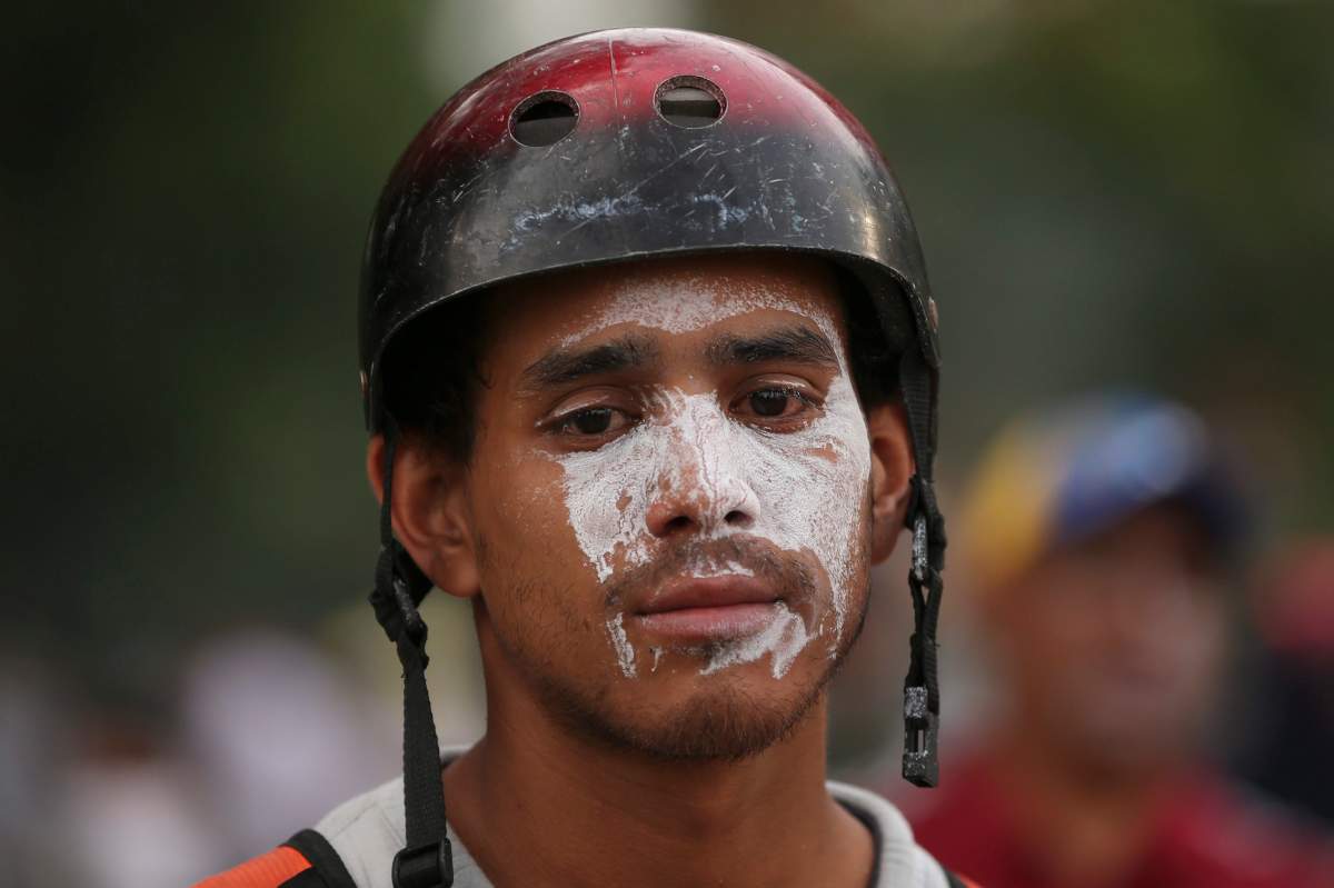 An anti-government protester wears a helmet during a break in clashes with security forces in Caracas, Venezuela, Wednesday, April 19, 2017. Tens of thousands of opponents of President Nicolas Maduro flooded the streets of Caracas in what’s been dubbed the “mother of all marches” against the embattled president. (AP Photo/Fernando Llano)
