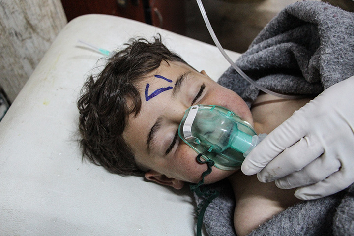 A Syrian child receives treatment after an alleged chemical attack at a field hospital in Saraqib, Idlib province, northern Syria, April 4, 2017. 