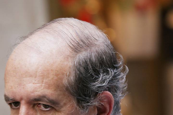 A balding man stands in Midtown Manhattan June 26, 2003 in New York City. 