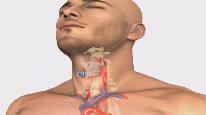 Saskatoon man helping cancer patients find their voice - image