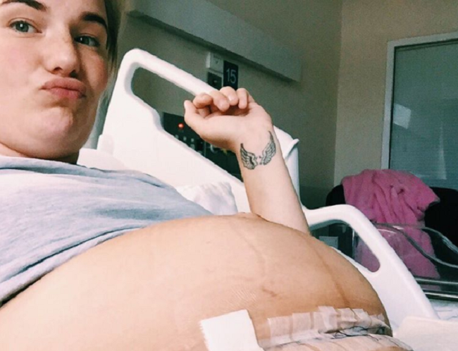 Australian mom Olivia White posted this photo on Instagram of herself recovering after giving birth to her second daughter by C-section in 2016.