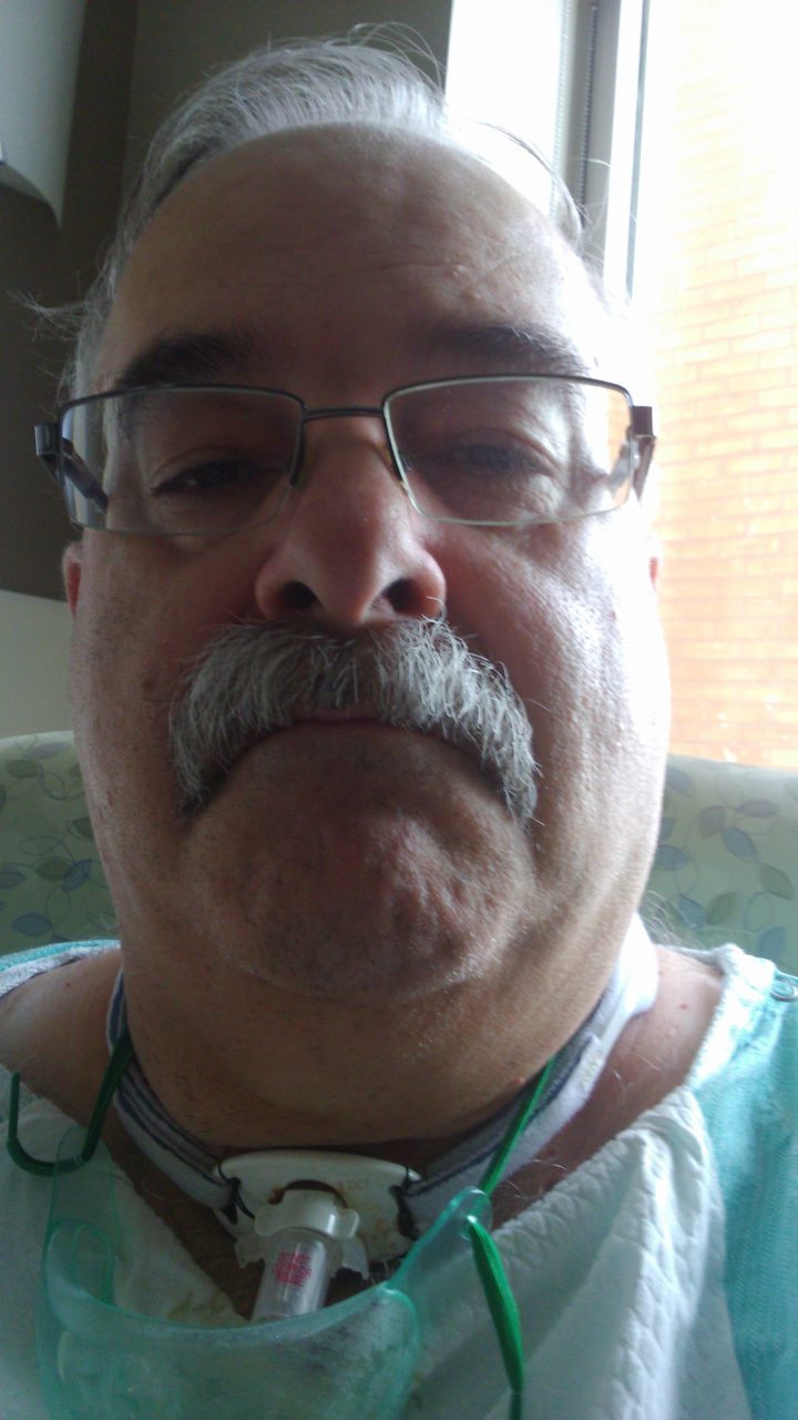 Through the use of a stoma, Brian can now talk again and two years later is still adjusting to his new normal.