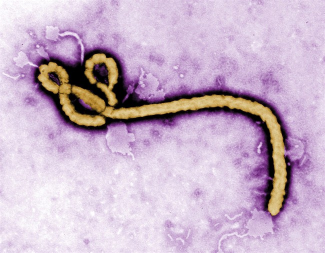 In this undated colorized transmission electron micrograph file image made available by the CDC shows an Ebola virus virion.